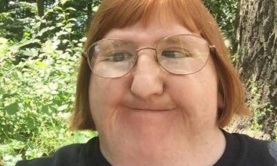 Melissa Blake